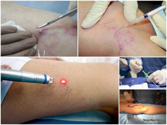 Τύποι θεραπείας